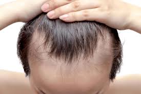 Cutecat Hair Beauty System – Vitamine für die Haare - test – in apotheke – kaufen
